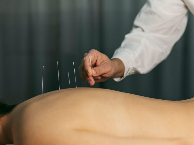 Иглоукалывание: научное обоснование древнего метода лечения
