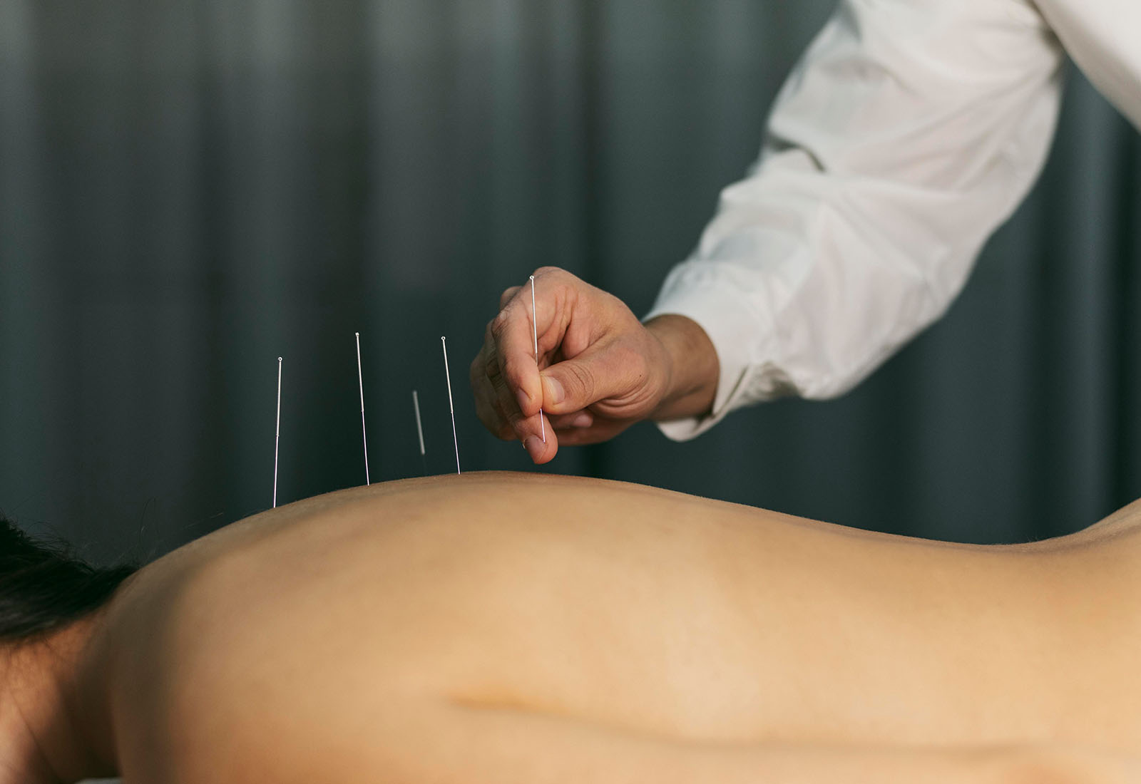 ИГЛОУКАЛЫВАНИЕ