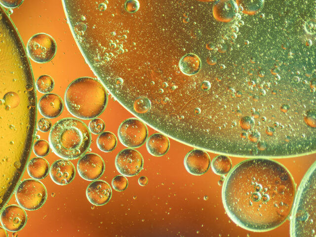 Опасен ли холестерин? Разбираем «плохой» и «хороший» липопротеин