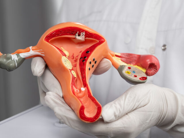 Фотодинамическая терапия в гинекологии: современный подход к лечению заболеваний